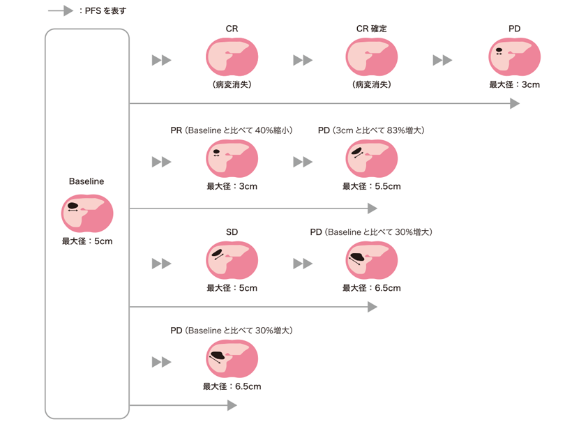 図4 腫瘍縮小効果とPFS