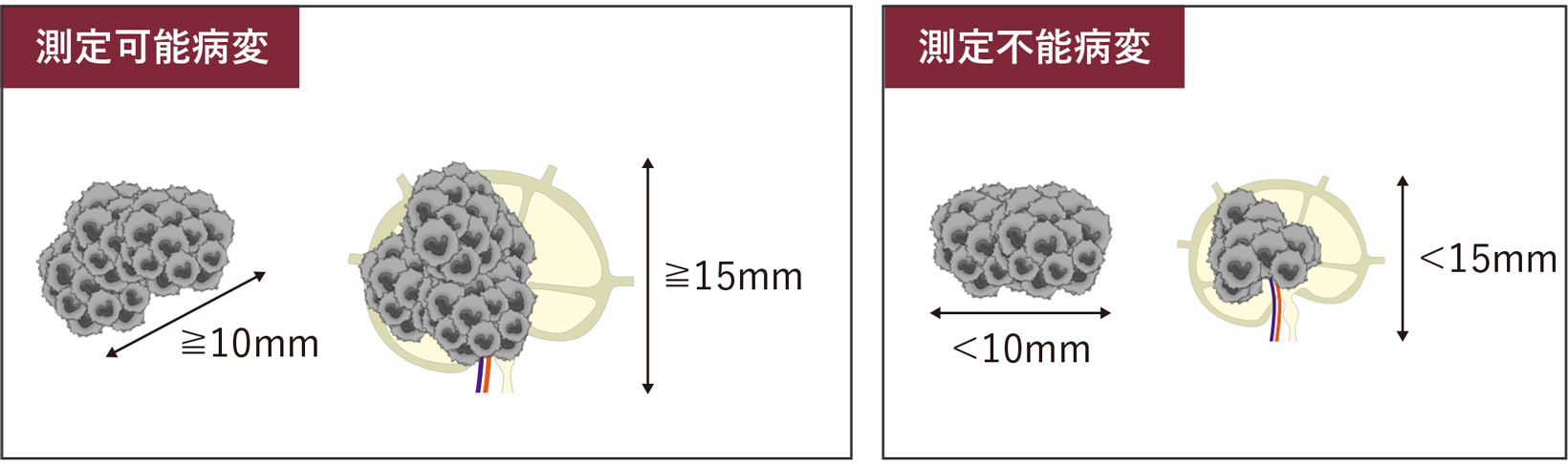 治療開始前（ベースライン）評価